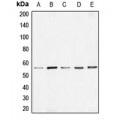 LifeSab™ BMP7 Rabbit pAb (50 µl)