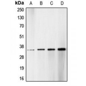 LifeSab™ CDK1/2/3 (pT14) Rabbit pAb (50 µl)