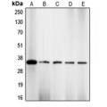 LifeSab™ CDK2 (pT160) Rabbit pAb (50 µl)