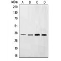 LifeSab™ Ephrin B3 Rabbit pAb (50 µl)