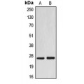LifeSab™ EIF4E Rabbit pAb (50 µl)