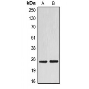 LifeSab™ EIF4E Rabbit pAb (50 µl)