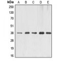 LifeSab™ ERCC1 Rabbit pAb (50 µl)