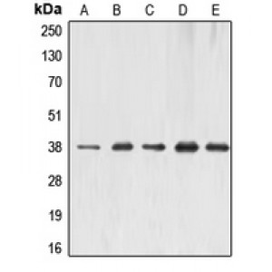 LifeSab™ ERCC1 Rabbit pAb (50 µl)