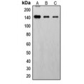 LifeSab™ FGFR1 (pY766) Rabbit pAb (50 µl)
