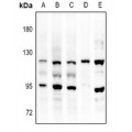 LifeSab™ FGFR3 Rabbit pAb (50 µl)
