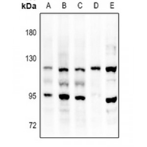 LifeSab™ FGFR3 Rabbit pAb (50 µl)