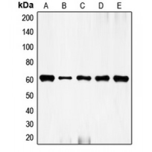 LifeSab™ c-FOS Rabbit pAb (50 µl)