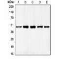 LifeSab™ GATA4 Rabbit pAb (50 µl)