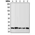 LifeSab™ Granzyme B/H Rabbit pAb (50 µl)