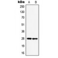 LifeSab™ HOXB9 Rabbit pAb (50 µl)