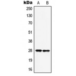 LifeSab™ HOXB9 Rabbit pAb (50 µl)