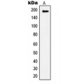 LifeSab™ IRS1 (pS1101) Rabbit pAb (50 µl)