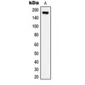 LifeSab™ IRS1 (pS307) Rabbit pAb (50 µl)