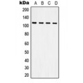 LifeSab™ CD61 Rabbit pAb (50 µl)