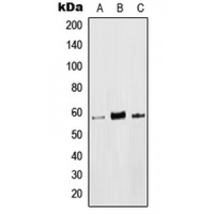 LifeSab™ LCK (pY393) Rabbit pAb (50 µl)