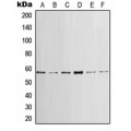 LifeSab™ LCK Rabbit pAb (50 µl)