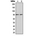 LifeSab™ MARCKS Rabbit pAb (50 µl)