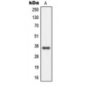 LifeSab™ MC4 Receptor Rabbit pAb (50 µl)