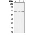 LifeSab™ Menin Rabbit pAb (50 µl)