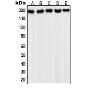 LifeSab™ PDGFR alpha Rabbit pAb (50 µl)