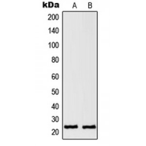 LifeSab™ RAN Rabbit pAb (50 µl)