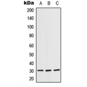 LifeSab™ RPS4X Rabbit pAb (50 µl)