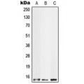 LifeSab™ S100-A10 Rabbit pAb (50 µl)
