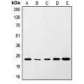 LifeSab™ SNAP25 Rabbit pAb (50 µl)