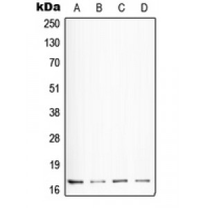 LifeSab™ Somatostatin Rabbit pAb (50 µl)