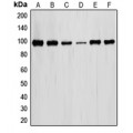 LifeSab™ STAT6 Rabbit pAb (50 µl)
