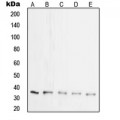 LifeSab™ Synaptophysin Rabbit pAb (50 µl)