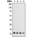 LifeSab™ TGF alpha Rabbit pAb (50 µl)