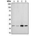 LifeSab™ TGF beta 2 Rabbit pAb (50 µl)