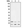 LifeSab™ TGF beta 3 Rabbit pAb (50 µl)
