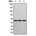 LifeSab™ THRA Rabbit pAb (50 µl)