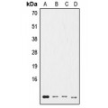 LifeSab™ Ub Rabbit pAb (50 µl)