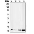 LifeSab™ UBE2D2 Rabbit pAb (50 µl)