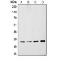 LifeSab™ PGP9.5 Rabbit pAb (50 µl)