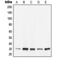 LifeSab™ 14-3-3 epsilon Rabbit pAb (50 µl)