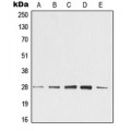 LifeSab™ 14-3-3 zeta Rabbit pAb (50 µl)