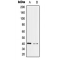LifeSab™ PRPF18 Rabbit pAb (50 µl)