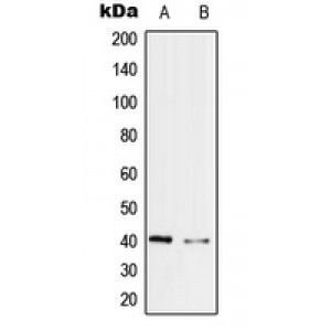 LifeSab™ PRPF18 Rabbit pAb (50 µl)