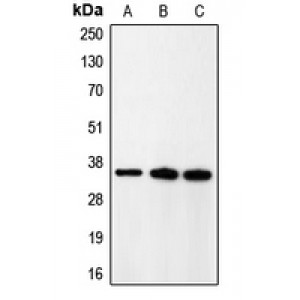 LifeSab™ CDK5R1 p35 Rabbit pAb (50 µl)