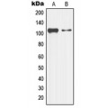 LifeSab™ LZK Rabbit pAb (50 µl)