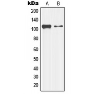 LifeSab™ LZK Rabbit pAb (50 µl)
