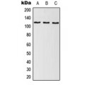 LifeSab™ SNRP116 Rabbit pAb (50 µl)
