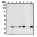 LifeSab™ BIM Rabbit pAb (50 µl)