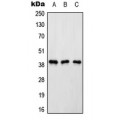LifeSab™ Renin Receptor Rabbit pAb (50 µl)