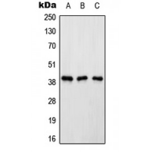 LifeSab™ Renin Receptor Rabbit pAb (50 µl)